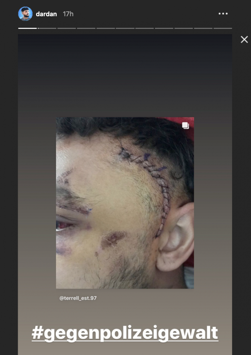 Dardan-via-Instagram-Story.png Dardan-via-Instagram-Story.png