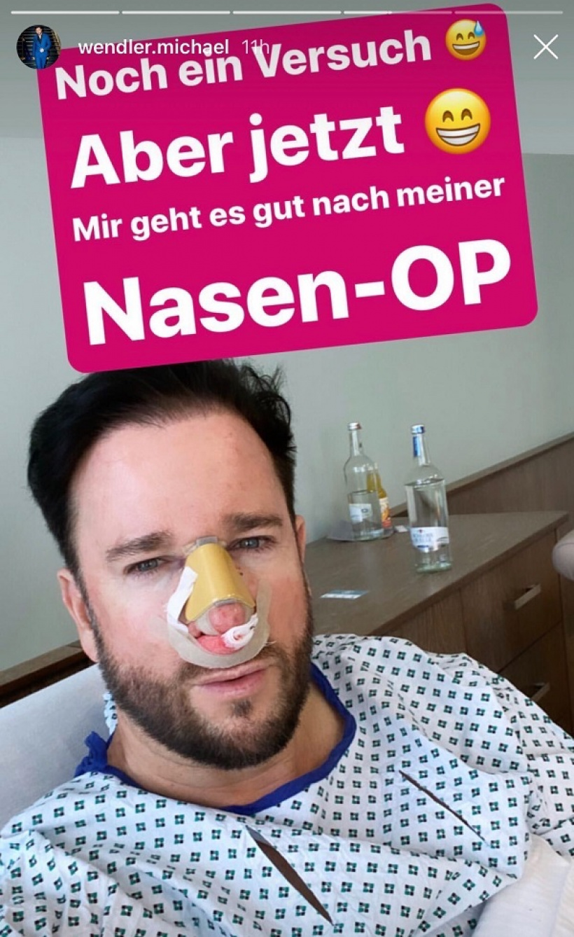 Michael-Wendler-nach-der-Nasen-OP.jpg Michael-Wendler-nach-der-Nasen-OP.jpg