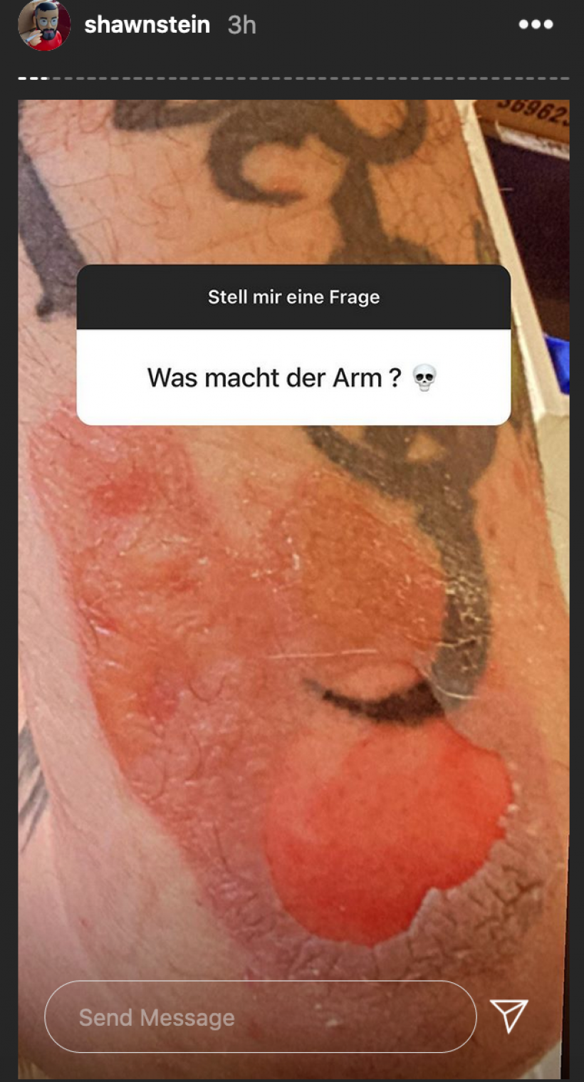 Sido-Wunde-vom-Horrorcamp-Instagram-02.11.2020.png Sido-Wunde-vom-Horrorcamp-Instagram-02.11.2020.png