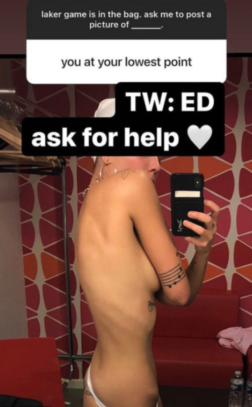 halsey-eating-disorder-photo.png halsey-eating-disorder-photo.png